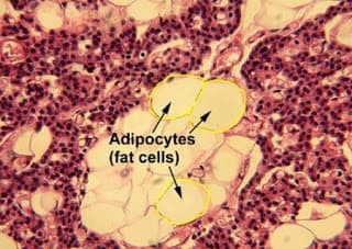Le cellule adipose rispondono di più all'insulina